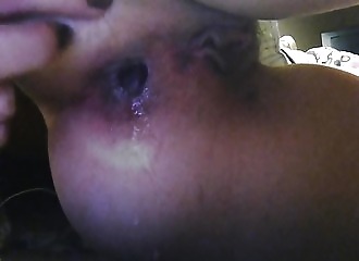 Ice in my ass